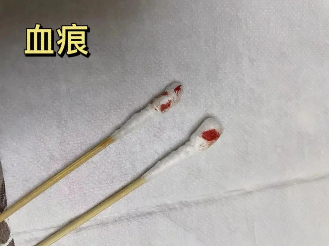 親子鑒定樣本采集棉棒上的血痕可以嗎？