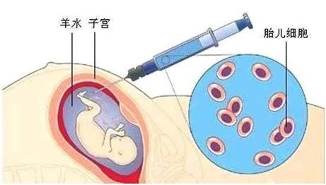無創胎兒親子鑒定、羊水親子鑒定、毛發親子鑒定分別怎么做？