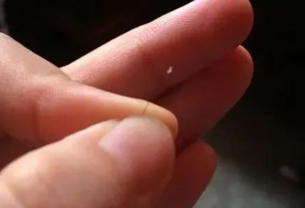 掉落的毛囊毛發(fā)可以拿去做染色體親子鑒定嗎？