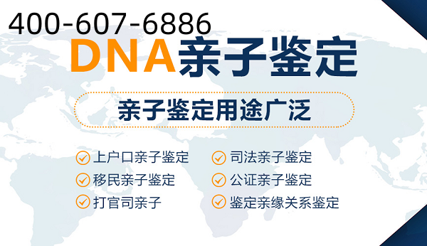 中山上戶口親子鑒定辦理有什么注意事項嗎？
