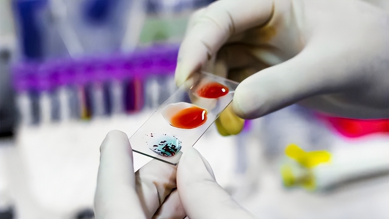 怎么用頭發(fā)做中山dna個人隱私親子鑒定？