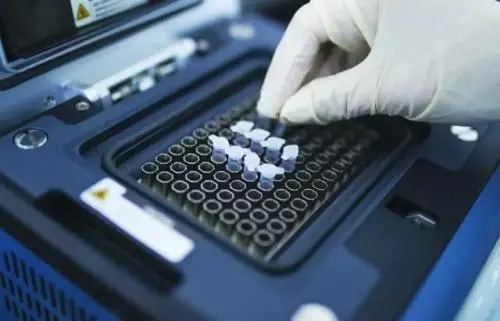 懷孕一個月可以做中山dna親子鑒定嗎？